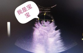 有过胎停育经历的姐妹们，你们后来顺利怀孕，生下来了吗？